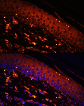 FSCN1 Antibody