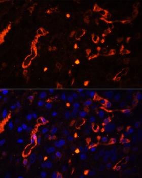 FSCN1 Antibody, KO Validated