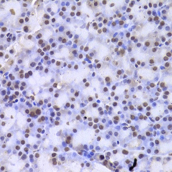 CSNK1E Antibody, KO Validated