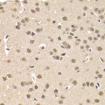 CSNK1E Antibody, KO Validated