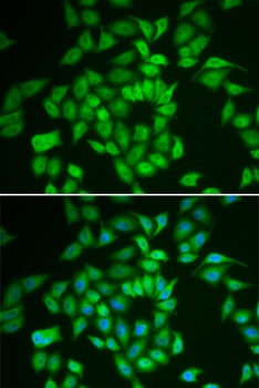 CSNK1E Antibody