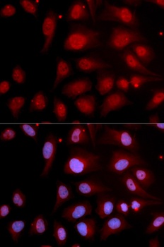 POLB Antibody, KO Validated