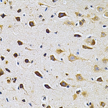 ADRBK1 Antibody, KO Validated