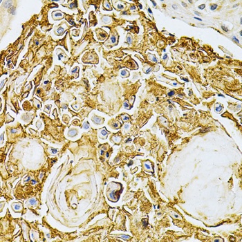 ADRBK1 Antibody, KO Validated