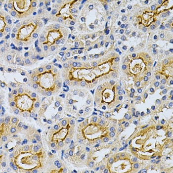 ADRBK1 Antibody, KO Validated