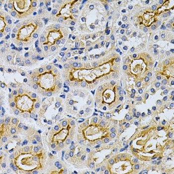 ADRBK1 Antibody