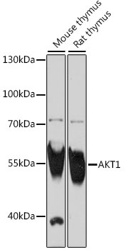 AKT1 Antibody, KO Validated