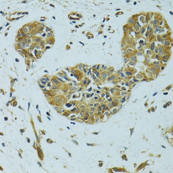 HSPB1 Antibody, KO Validated