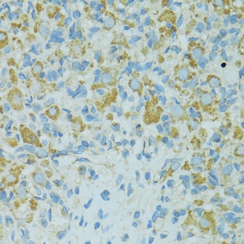 HSPB1 Antibody, KO Validated