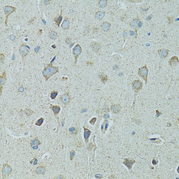 HSPB1 Antibody, KO Validated