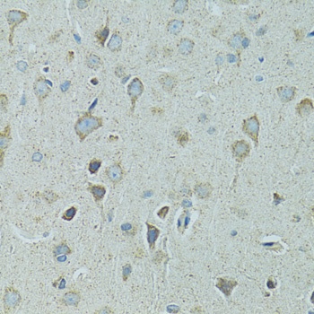 HSPB1 Antibody