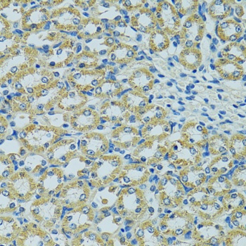 HSPB1 Antibody, KO Validated