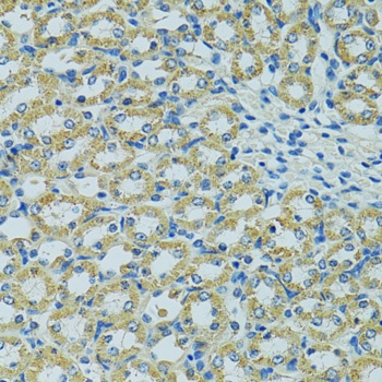 HSPB1 Antibody