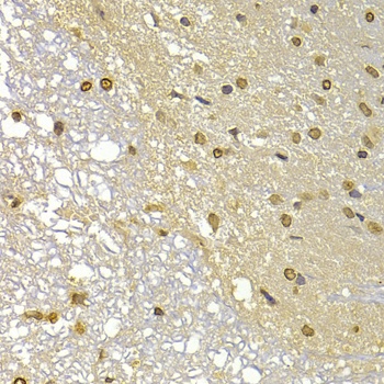 S100A4 Antibody, KO Validated