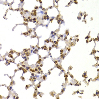 S100A4 Antibody, KO Validated
