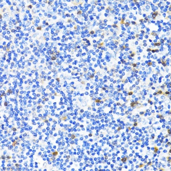 S100A4 Antibody