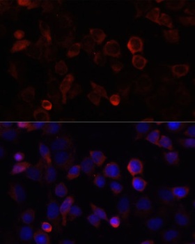 S100A4 Antibody, KO Validated