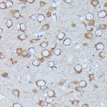 S100A4 Antibody, KO Validated