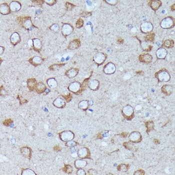 S100A4 Antibody