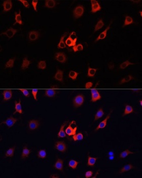 S100A4 Antibody, KO Validated