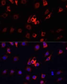 S100A4 Antibody