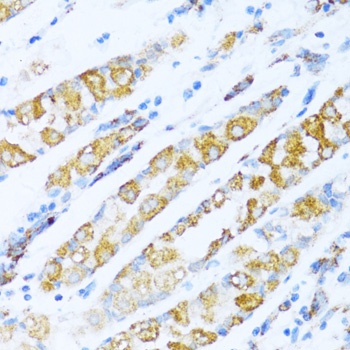 NDUFA5 Antibody