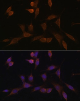 NDUFA5 Antibody