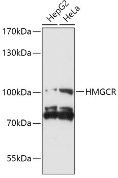 HMGCR Antibody, KO Validated