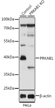 PRKAB1 Antibody