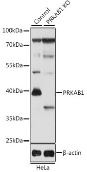 PRKAB1 Antibody, KO Validated