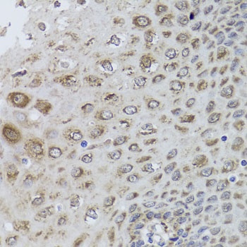 PRKAB1 Antibody, KO Validated