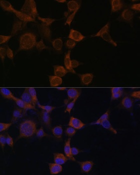 PRKAB1 Antibody