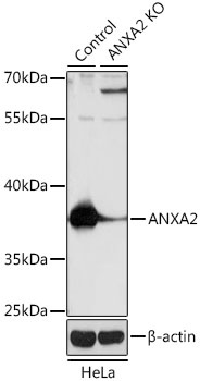ANXA2 Antibody, KO Validated