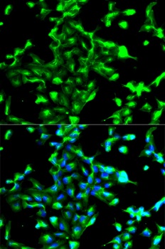 ANXA2 Antibody, KO Validated