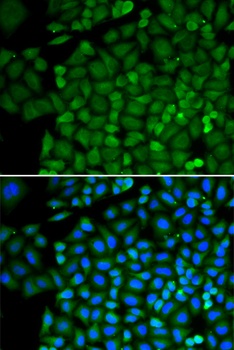 SELENBP1 Antibody, KO Validated