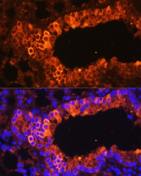 BAX Antibody