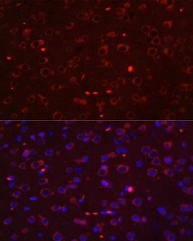 STAT3 Antibody