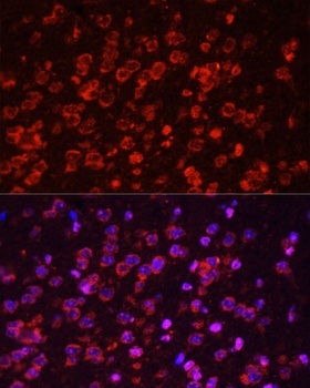 STAT3 Antibody