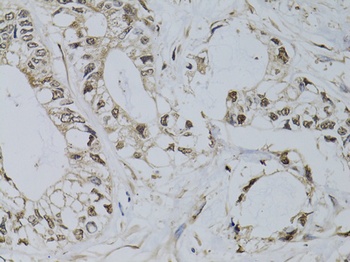 PML Antibody, KO Validated