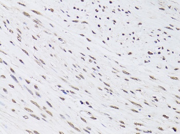 PML Antibody, KO Validated
