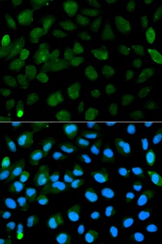 PML Antibody, KO Validated
