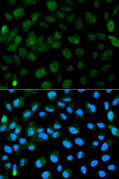 PML Antibody