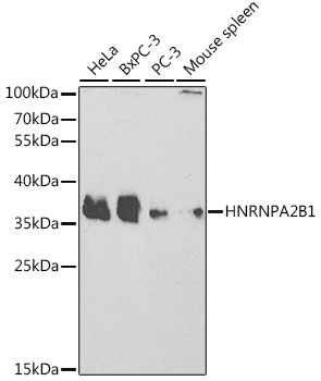 HNRNPA2B1 Antibody, KO Validated