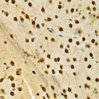 HNRNPA2B1 Antibody, KO Validated