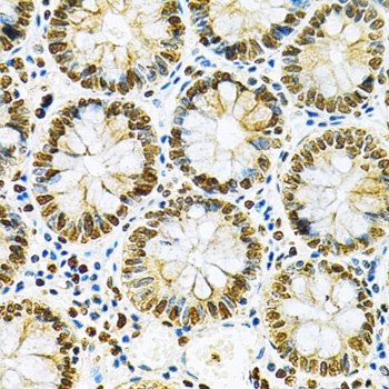 HNRNPA2B1 Antibody, KO Validated