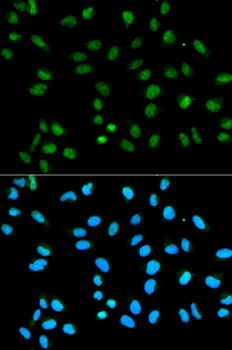 HNRNPA2B1 Antibody