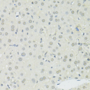 HNRNPA2B1 Antibody, KO Validated