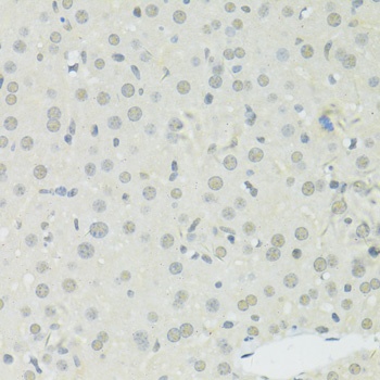 HNRNPA2B1 Antibody