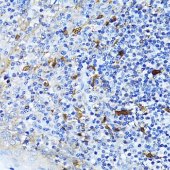 beta Catenin Antibody, KO Validated