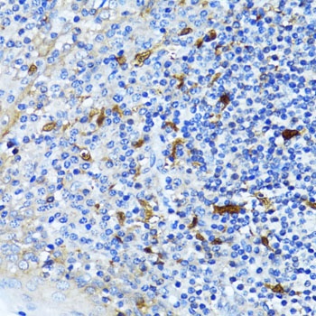 CTNNB1 Antibody